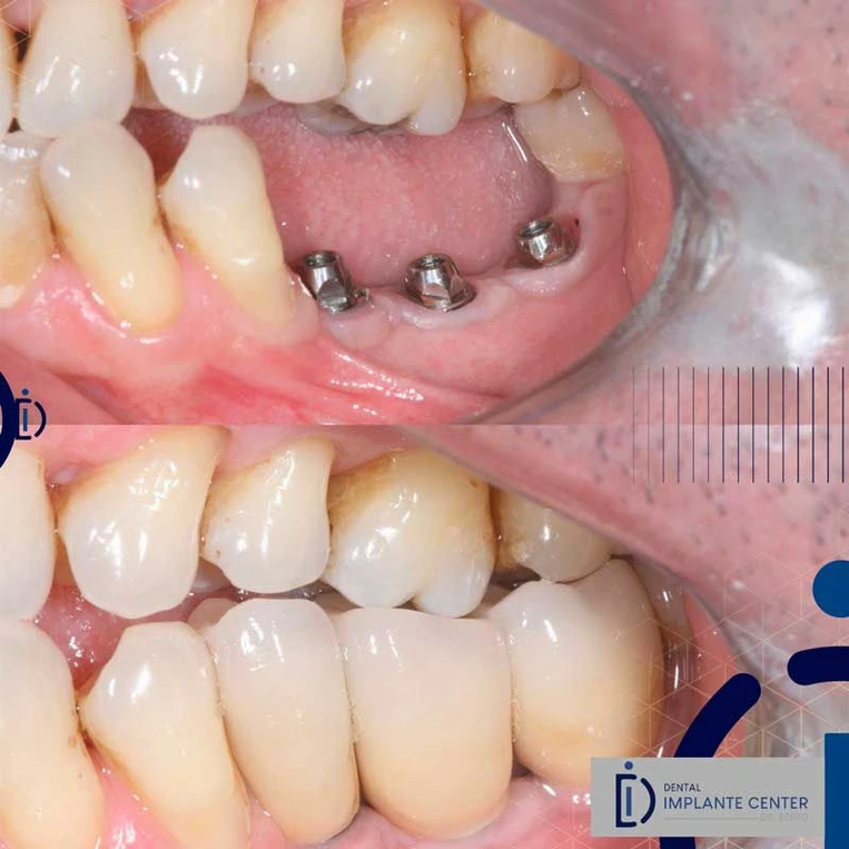 a2a9cb_71497927bd564ba7b350741499c4d282~mv2