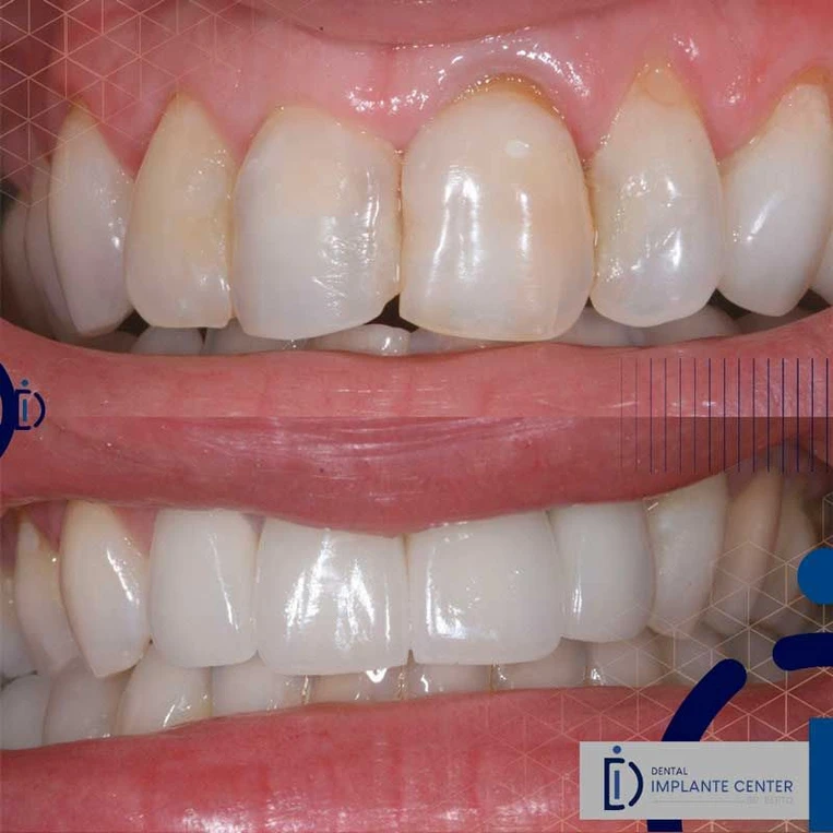 a2a9cb_81f56b70f444422cb23469accaf0bb95~mv2