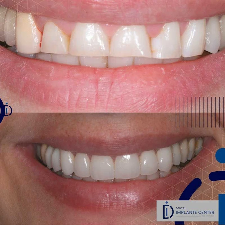 a2a9cb_886e6426f1874f14bf27563b601a5219~mv2