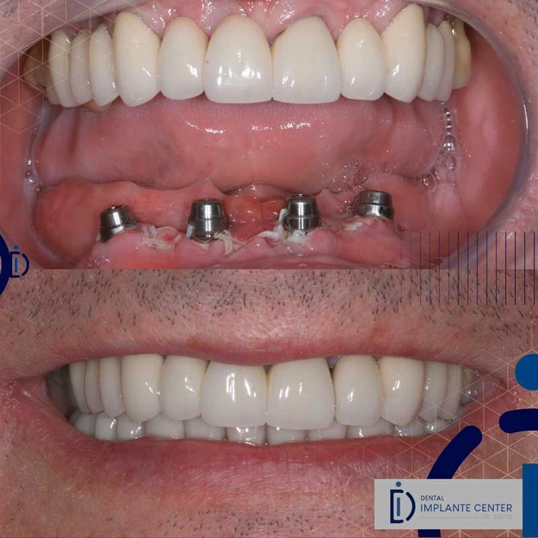 a2a9cb_93c32df5c9e140caaa86e269cf2cfb83~mv2